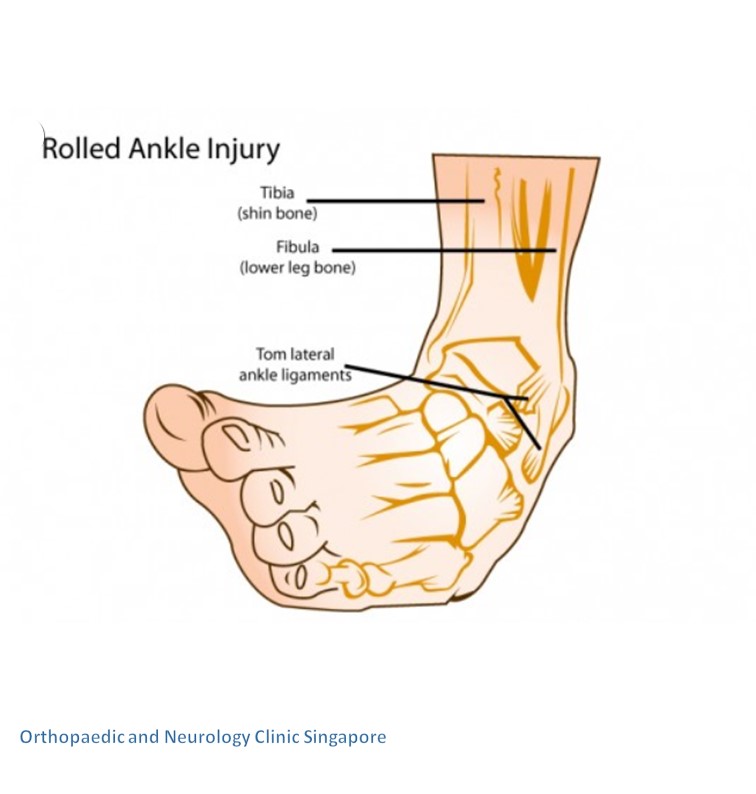 Ankle Pain Clinic 脚踝诊所